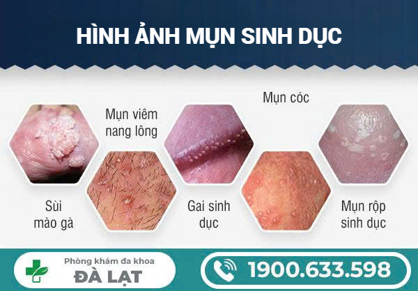 Hình ảnh minh họa